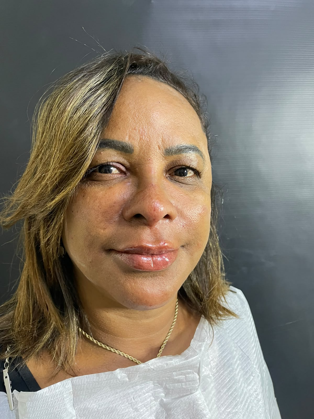 Depois do procedimento